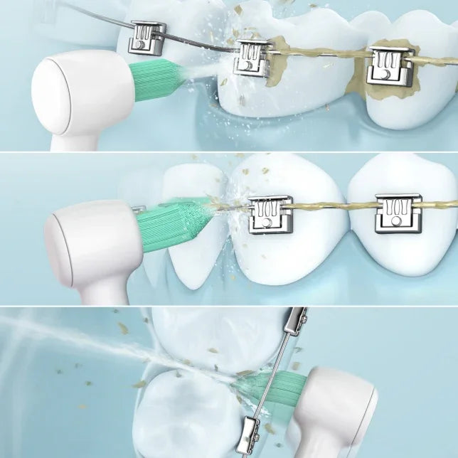 Panasonic Oral Irrigator w/ Orthodontic Nozzle & Ultrasonic Technology - White - LX2001 - Homewares, Outdoor, Phone Accessories, Cases, Speakers, Headphones + More -