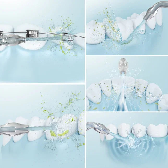 Panasonic Oral Irrigator w/ Orthodontic Nozzle & Ultrasonic Technology - White - LX2001 - Homewares, Outdoor, Phone Accessories, Cases, Speakers, Headphones + More -